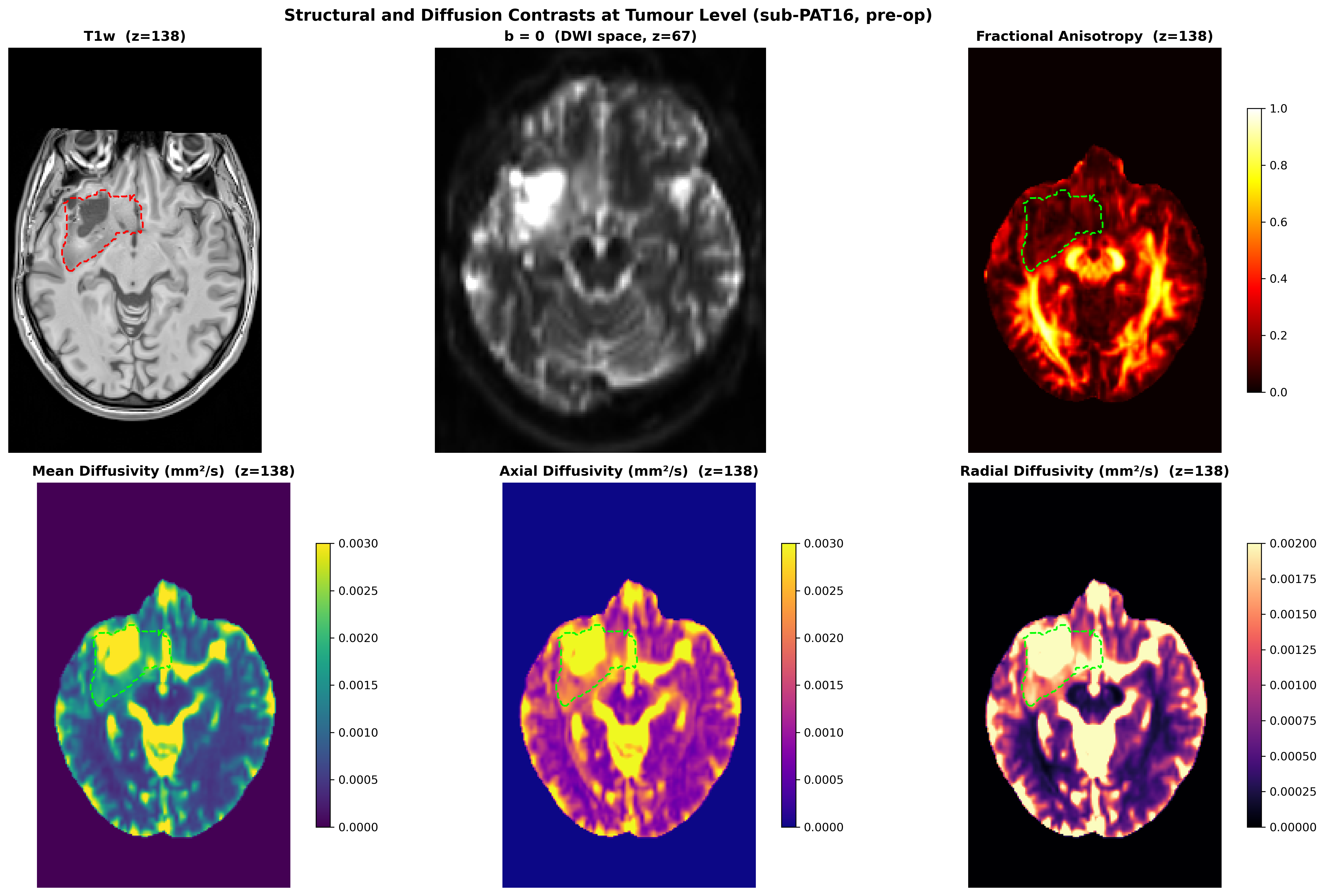 DTI scalar maps