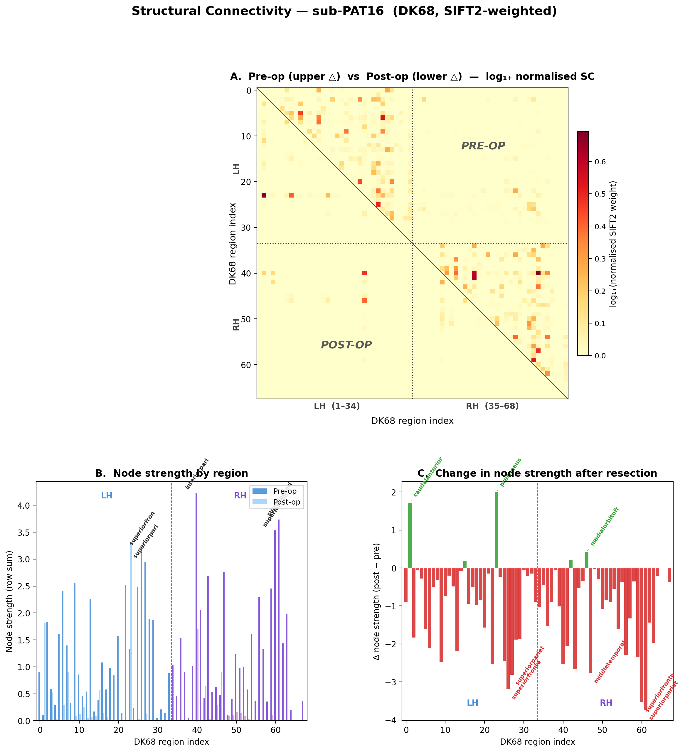 Structural connectivity matrix
