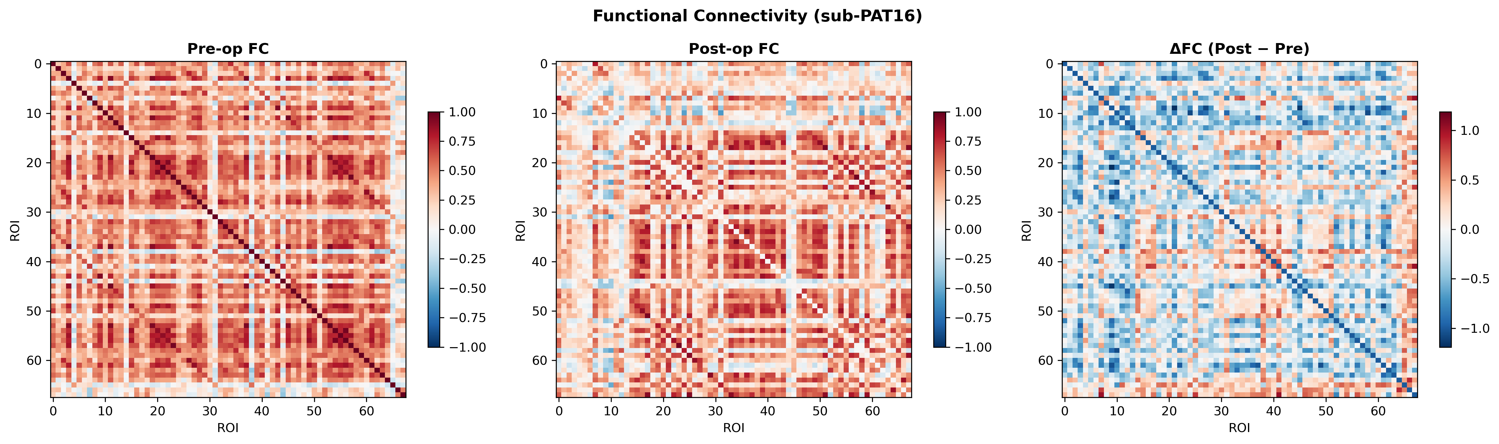 Functional connectivity matrices
